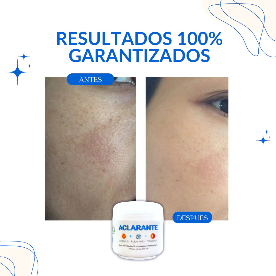Crema Aclarante Zamia - Resultados 100% Garantizados
